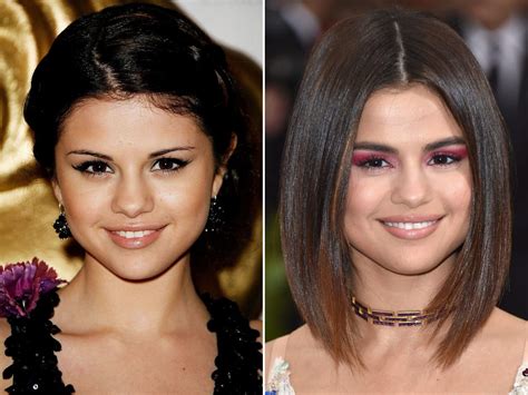 Selena Gomez Plastic Surgery Revealed! Before and After